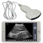 Pocket Ultrasound System