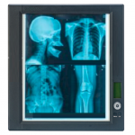 X-ray film view panel XFVP-1000B